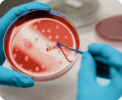 Healthcare professional performing a bacterial culture test on a petri dish in a laboratory setting in New York City