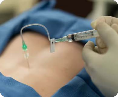 Close-up of a spinal epidural injection being administered to a patient in New York City, with a focus on the needle and injection site