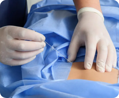 Close-up of a healthcare professional performing a spinal injection needle insertion for treatment, with focus on the needle and patient's lower back in New York City