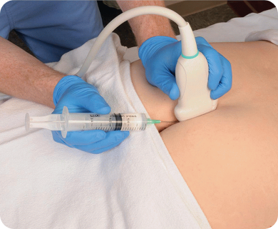 Healthcare professional performing an ultrasound-guided spinal injection to the lower back of a patient in New York City